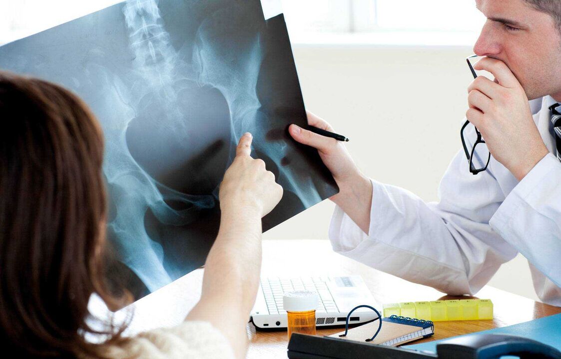 médicos examinando radiografías para la osteoartritis de cadera